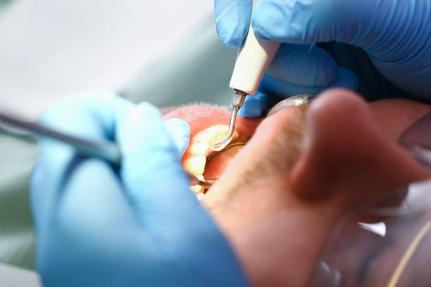 Best Mobile Emergency Dentist in Pensacola Station, FL
